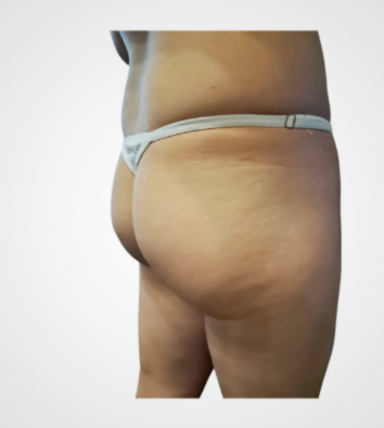 Barbiboy használt tanga – fehér csipkés Barbiboy worn white lace thong – real used underwear for fetish fans
